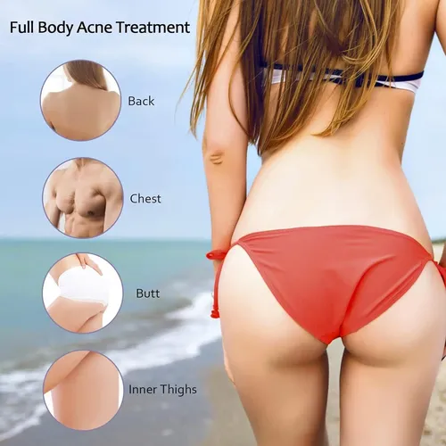 Crema Corporal Antiacné Loción Loción 130g Para Espalda