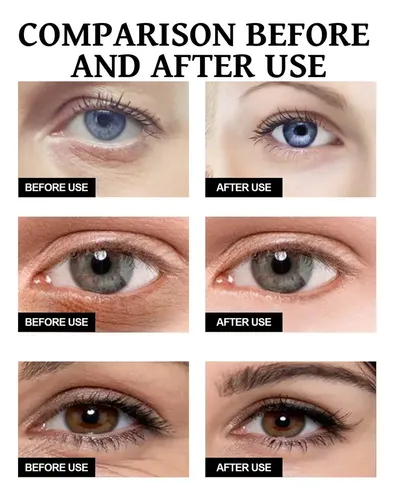 3×útil Tensor Ojos Instantáneo,la Mejor Crema For Bolsas .