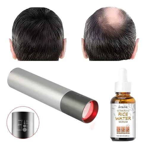 Serum Vitalidad Pelo Fuerte + Láser Portable Estimula Grosor