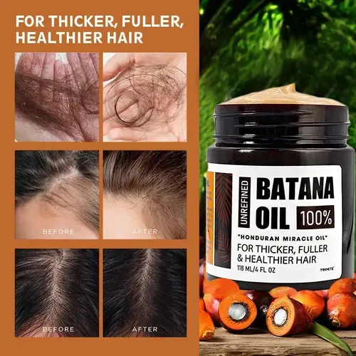 Aceite Capilar Batana, Nutre Y Da Volumen Al Cabello *-*