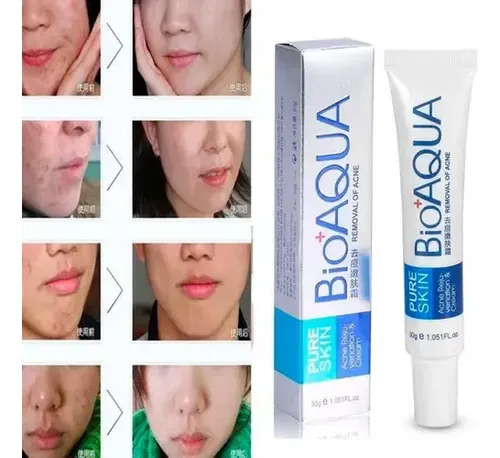 Paquete 3 Cremas Bioaqua Puntos Negros Anti Acne