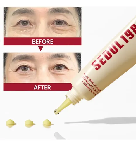 Crema Retiniana Para Ojos, Reduce Las Ojeras, Aprieta, 30 Ml Todo Tipo De Piel Día/noche