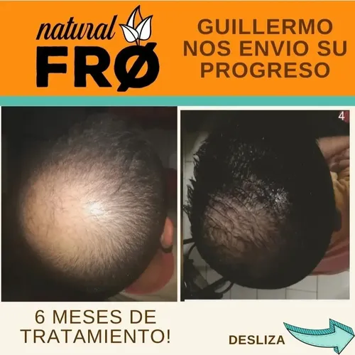 Loción Capilar Calvicie-crecimiento-caida X 200ml