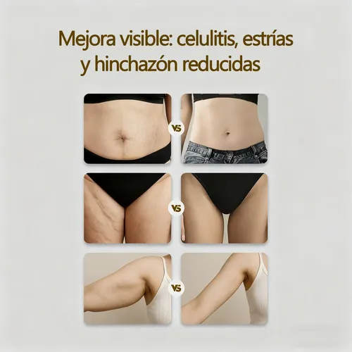 Masajeador Drenaje Linfático Anticelulítico Cuerpo Entero