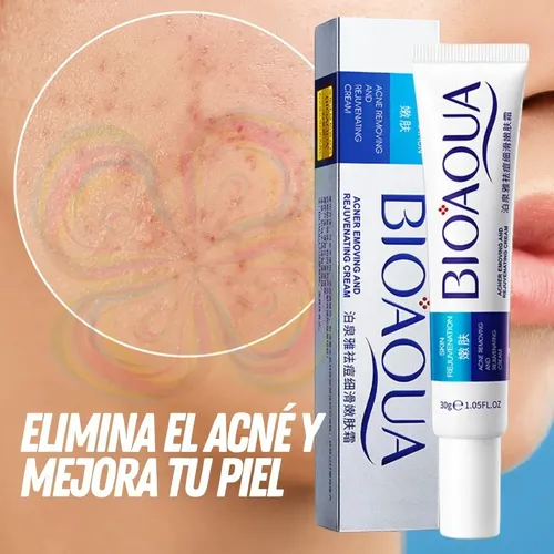 Pcrema Para El Acné Cicatrices Poros Control De Grasa, 2 Pen
