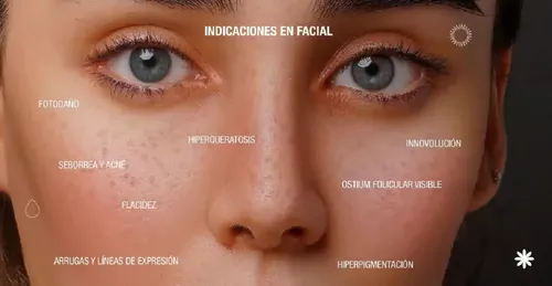 Peeling Acido Mandelico 10% Arrugas Poros Luminosidad Mancha