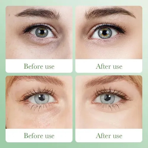 Parches De Aloe Vera Y Colágeno Akary Para Ojos