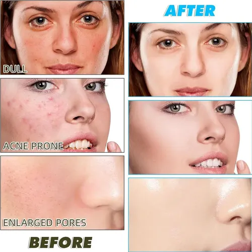 Set De 3 Limpiadores Faciales En Mousse De Cúrcuma