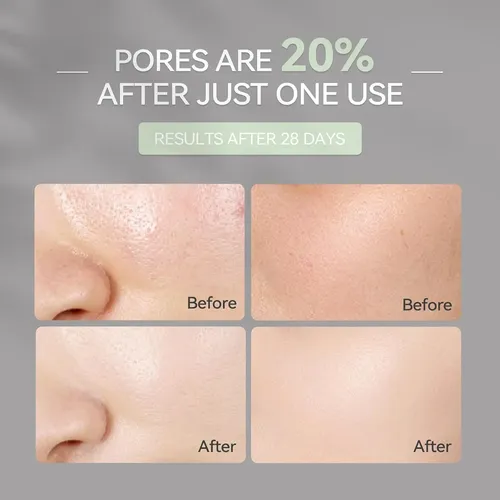Mascarilla Limpiadora De Arcilla Wnp Duo Con Niacinamida Y Á