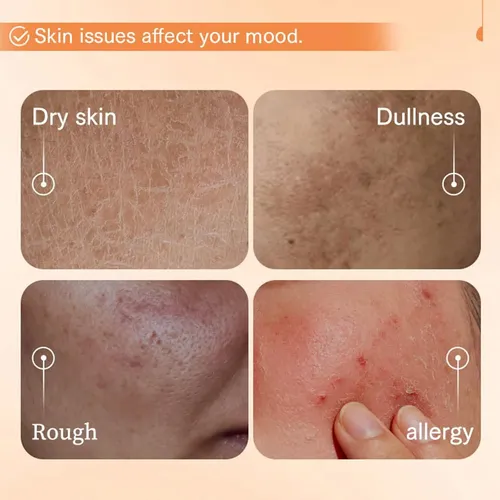 Tónico Arroz,tónico Facial Hidratante Para Una Piel Luminosa