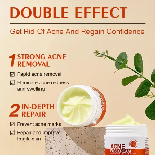 Z. Crema De Acné Crema De Espinillas Para La Cara,