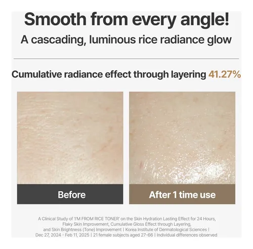 Soy From Rice Toner, Tónico De Arroz Con Leche Korea Glow,