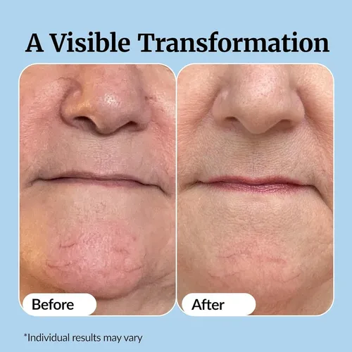 Esencia Hidratante, Nutritiva Y Exfoliante