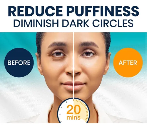 Parches Para Ojeras Y Ojos Hinchados (30 Pai…