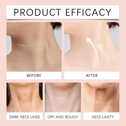 Crema Reafirmante Para El Cuello Con Rodillo, Loción Corpora