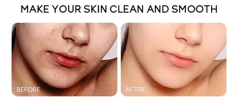 Limpiador Facial De Poros Sakuras Dating Hose En 50 G