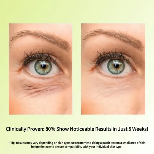 Serum Facial Con Retinol Alta Concentración 15 Ml