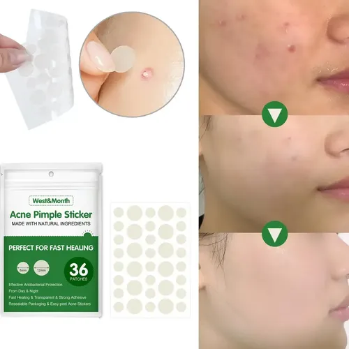 Parche Impermeable Para El Acné Que Absorbe Las Espinillas,
