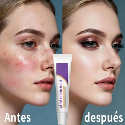 Sérum Facial 15% Ácido Azelaico – Genérico 30ml