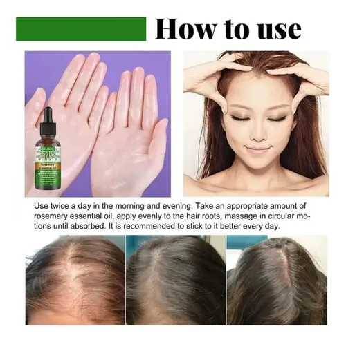 Aceite De Romero Para El Crecimiento Del Cabello, 30 Ml, Cre