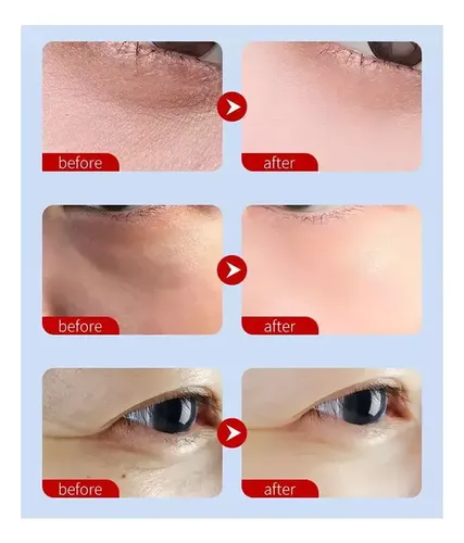 Parche De Colágeno Contorno De Ojos Hidratante Ojeras X5