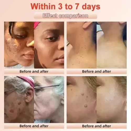 Quarxeri Purificante Exfoliante, Gel Exfoliante Avanzado Vs