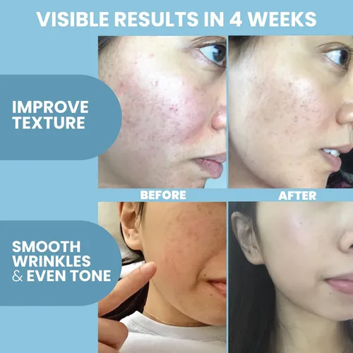 Sérum De Colágeno Eva Naturals Sérum Facial Antienvejecimien Todo Tipo De Piel Día/noche