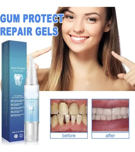 I Gel Reparador Encías Gumcaregel – Paquete De 2 Unidades I