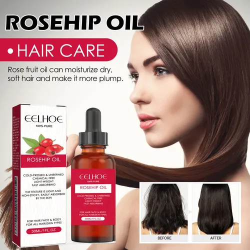 Aceite Facial De Rosa Mosqueta Eelhoe Hidratante Facial Y Corpora