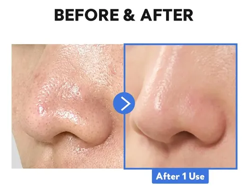 Bálsamo Limpiador Tirtir Hydro Boost Enzyme 120 Ml (paquete