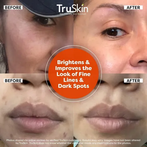 Sérum Facial De Vitamina C Truskin, 30 Ml, 1 Unidad