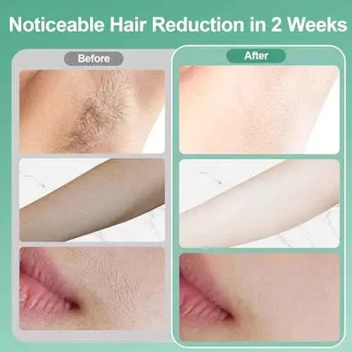 Depiladora Portátil Mujer Easy Glide Para Uso Diario