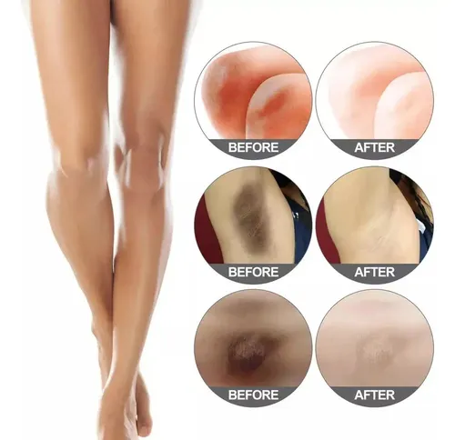 Loción Blanqueadora Corporal Hidratante Cuidado Eficaz 60 Gs