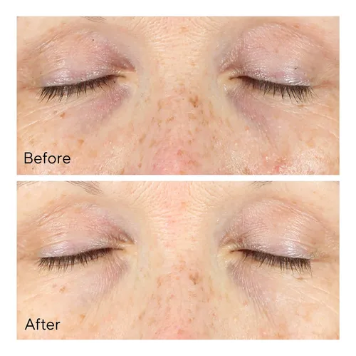 Corrector De Ojeras Murad Vita-c Eyes