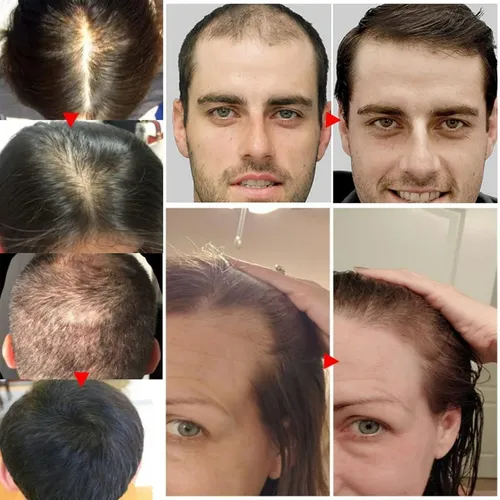 Aceite Para El Crecimiento Y Tratamiento Del Cabello Vvd Ros