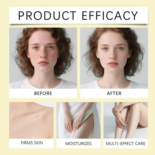 Wocrema Hidratante Y Protectora Que Cuida Suavemente La Piel