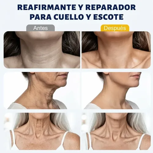 Crema Cuello Nexdrivo Retinol Reafirmante Rodillo 100ml