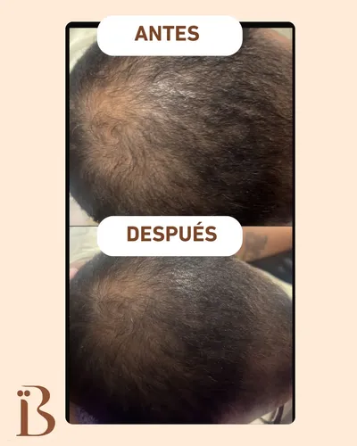 Serum Capilar Anticaída Y Reparación 2 En 1