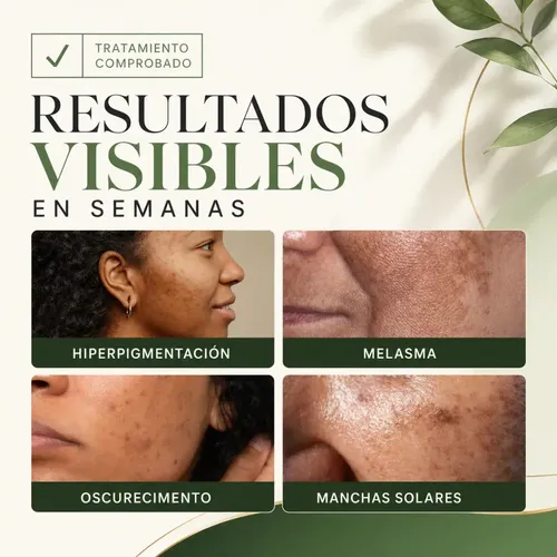 Kit Rutina Facial Completa Skincare 4 Pasos Día y Noche Agua Micelar + Tónico Facial + Sérum Vitamina C + Crema Ácido Hialurónico con Filtro Solar – Antiedad e Hidratación – 2 Meses – Green Is Good