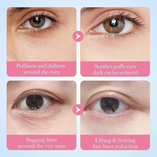 Parches Hidrogel Ojos Sadoer Colágeno Sakura Elimina Ojeras Todo Tipo De Piel Día/noche