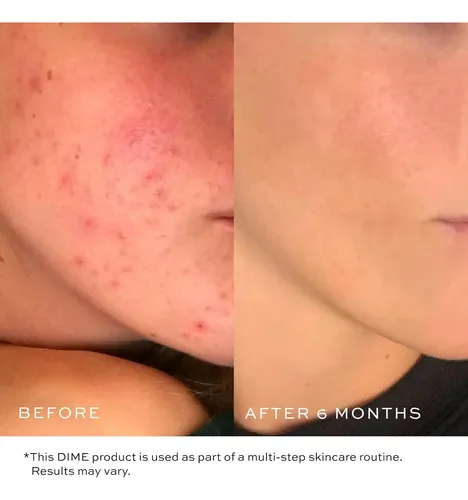 Dime Beauty Limpiador En Gel Suave Hidratante Desmaquillante