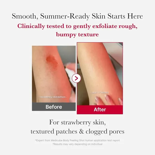 Medicube Red Acne Body Peeling Shot Exfoliante Corporal110ml
