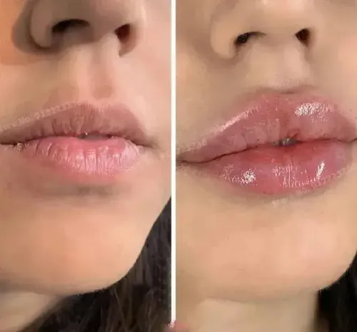 Aplicador Transparente Para Sueros Labiales Y Cosméticos