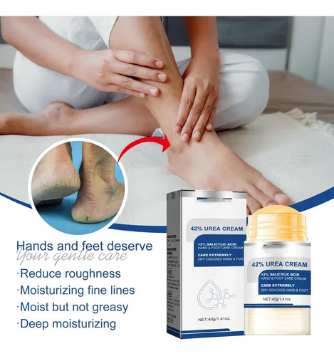 Crema De Urea Sssoelegant, Crema De Urea Para Pies Y Manos Para S