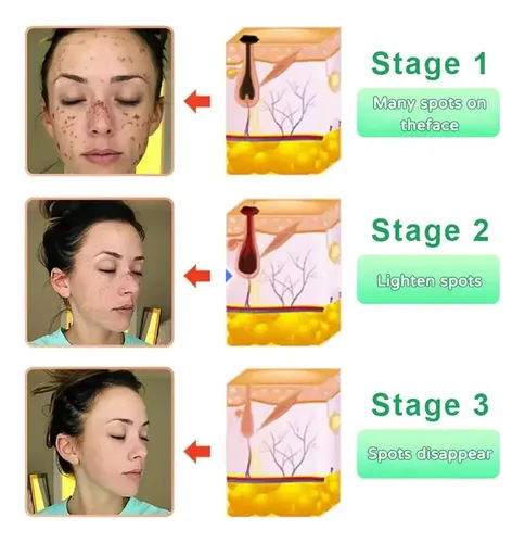 2025 Gel Exfoliante Purificante Quarxery Exfoliante 2 Ro Uy 6025634121253