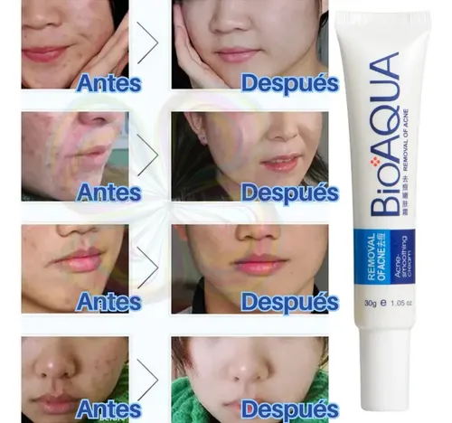 Paquete 3 Cremas Bioaqua Puntos Negros Anti Acne