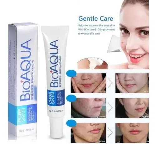 Crema Secativa Acné Bioaqua Cicatrices Y Quemaduras