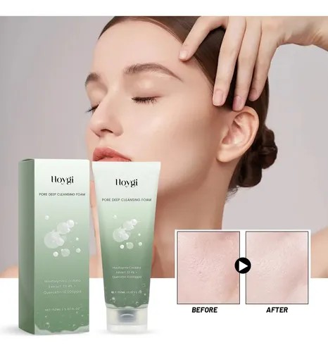 ! Limpiador Facial Limpiador De Poros Limpieza De Piel Facia