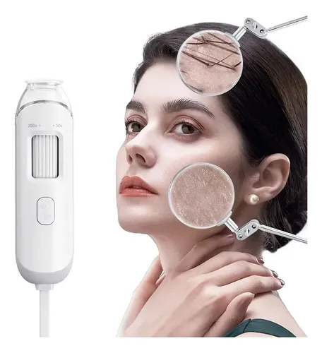 Máquina De Dermatoscopio, Analizador De Cuero Cabelludo Hd S