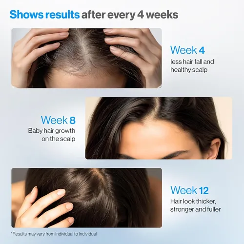 Sérum En Rollo Bodywise Para El Crecimiento Del Cabello, 25